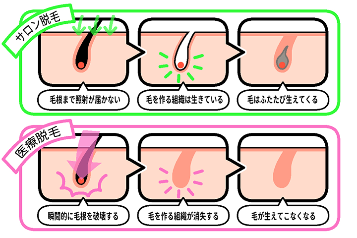 医師監修 おすすめ医療脱毛クリニック11選 料金 期間を徹底比較