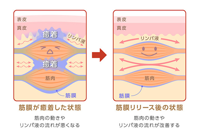 筋膜リリースガン マッサージ - 美容/健康