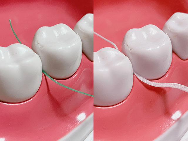 スレッド部を歯と歯の隙間に通し、フロス部で歯垢を除去する