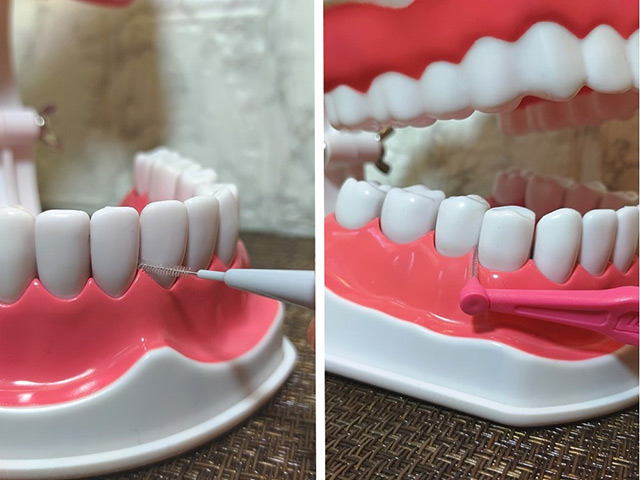 I字型（左）は前歯に、L字型（右）は奥歯に使いやすい