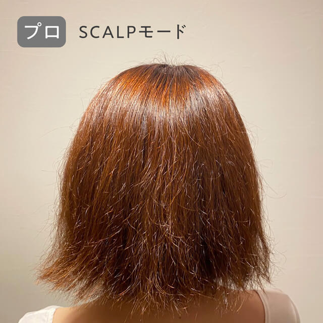 プロ_scalp
