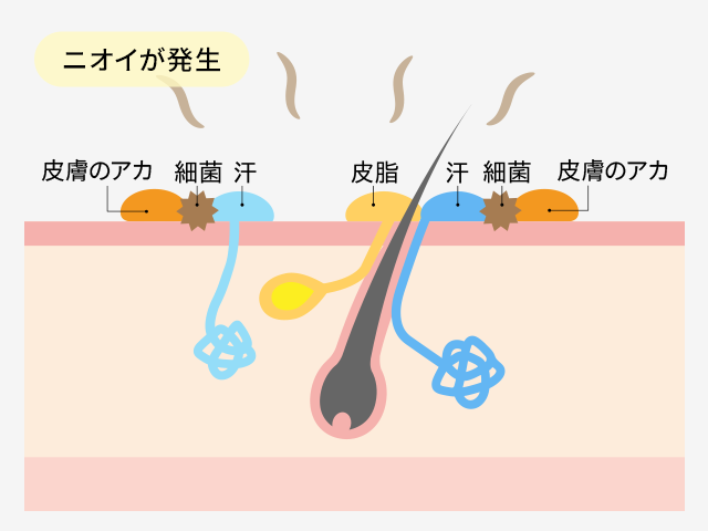 ニオイが発生