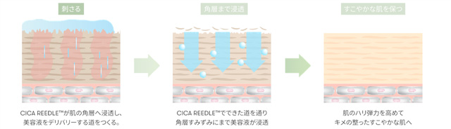 天然マイクロニードルの空洞からCICAが行き渡り、角層へ浸透しゆらいだ肌をサポートします