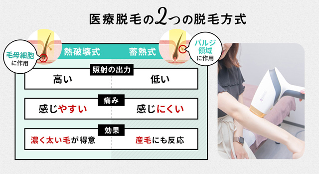脱毛機の2つの照射方法