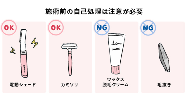 施術前の自己処理は注意が必要