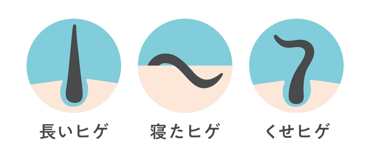 このようにヒゲにはさまざまなタイプがあるため、自分のヒゲの特徴を把握し、取りこぼさないように意識してシェービングすることが大切です