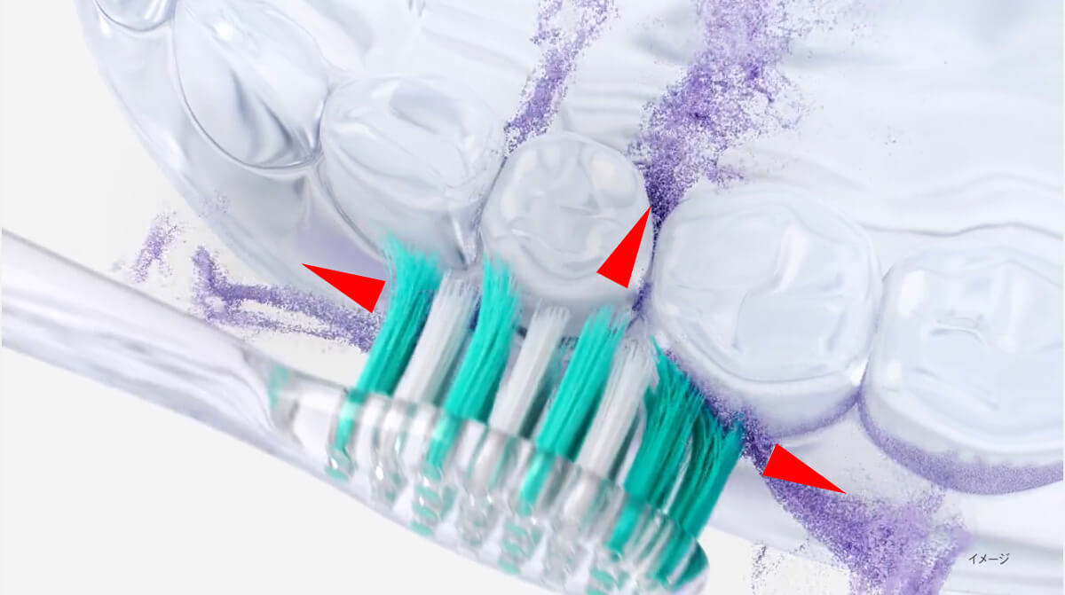 電動歯ブラシの駆動方式は、丸型ブラシが高速で回転する「回転式」や、歯軸に対してヨコに細かく動かす「バス・スクラビング方式」などさまざまですが、ドルツが上位モデル、レギュラーモデル共通でおもに採用しているのは音波振動によるバス・スクラビング方式。歯科医が歯周病予防の観点で推奨するブラッシング法（バス法やスクラビング法）を約1mm幅の細かな振動で再現し、歯周ポケットのプラーク※を、手磨きよりも速く、キレイに除去できるのが特徴です。