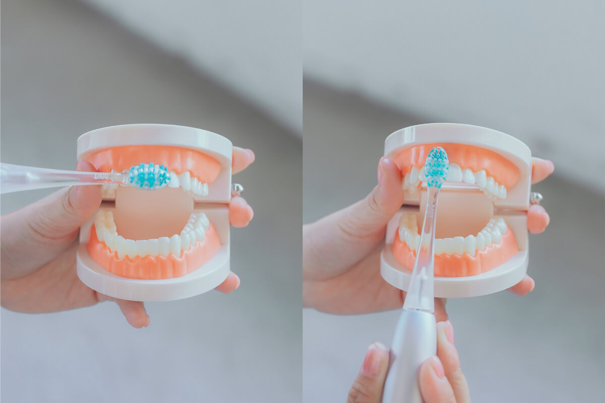 意外にも、前歯も磨き残しが多い部分。