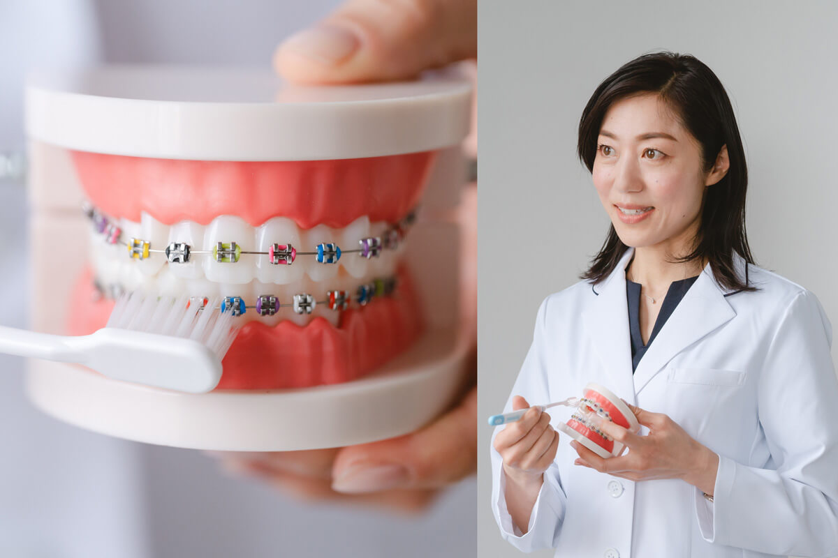 ワイヤーと歯の間