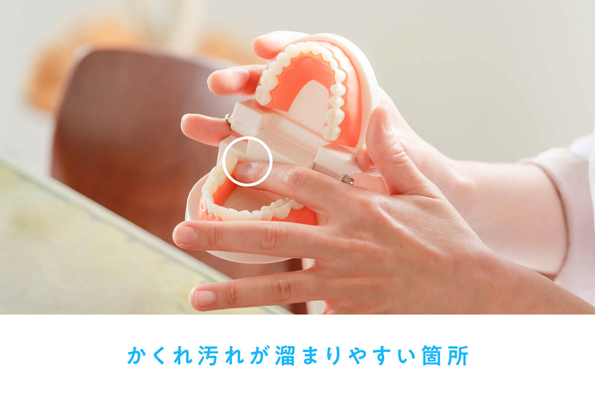 1. 歯垢が取れた実感がない