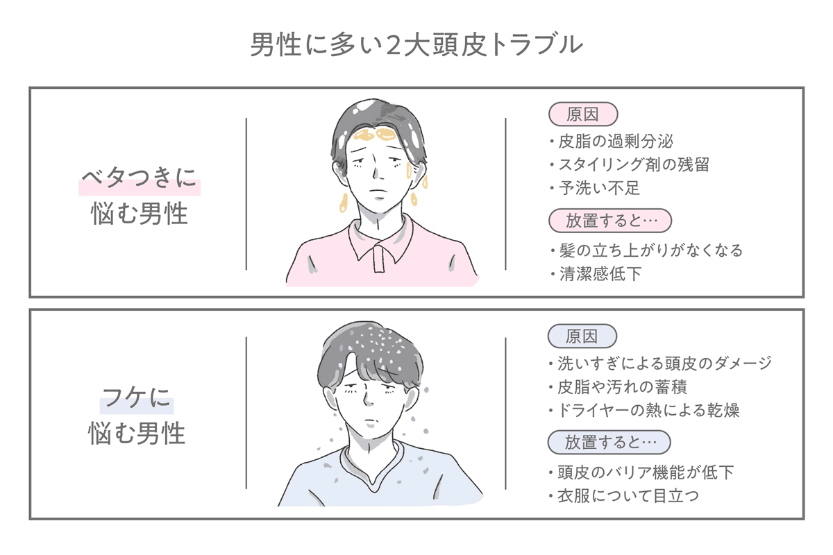 男性に多い2大頭皮トラブル