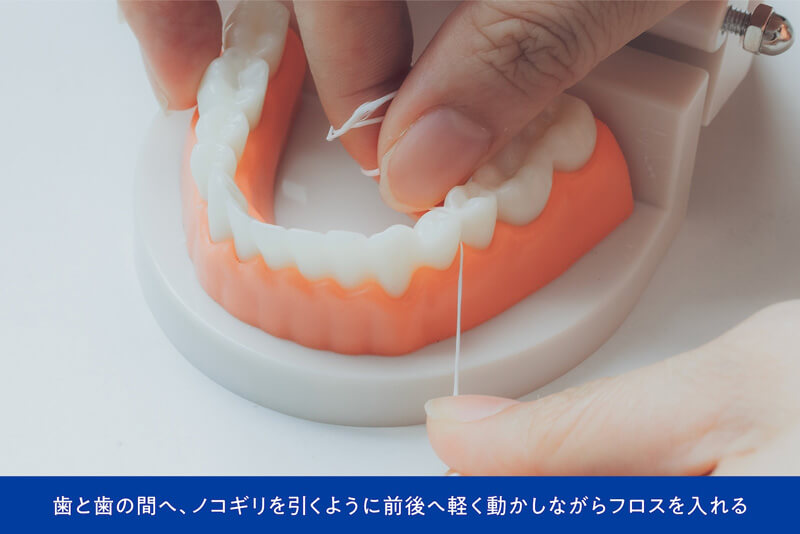 歯と歯の間へ、ノコギリを引くように前後へ軽く動かしながらフロスを入れる