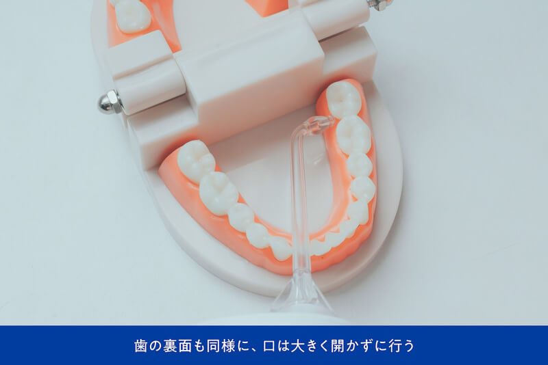 歯の裏面も同様に、口は大きく開かずに行う